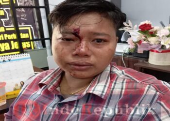 Penganiayaan Oknum Satpol PP Berujung Dilaporkan Korban Ke Polres Sampang