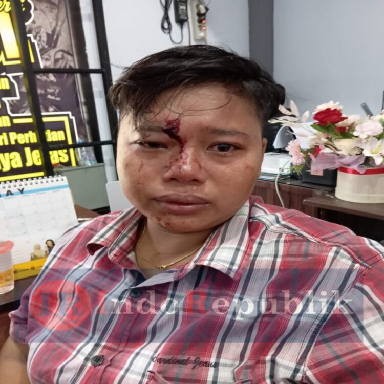 Penganiayaan Oknum Satpol PP Berujung Dilaporkan Korban Ke Polres Sampang