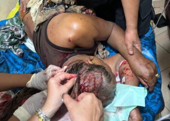 Dugaan Pengeroyokan, Mengakibatkan Korban Damarwi Luka Parah