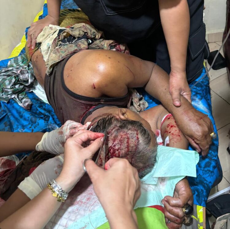 Dugaan Pengeroyokan, Mengakibatkan Korban Damarwi Luka Parah