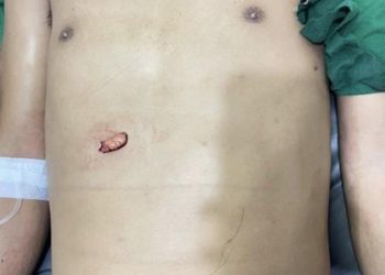 Ungkap Kasus Tindak Pidana Pembunuhan Atau Penganiayan Secara Bersama Sama Yang Mengakibatkan Meninggal Dunia Di Banyuasin